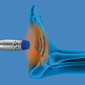 Zimmer enPuls Pro – Advanced Radial Pulse Wave Therapy System for Musculoskeletal Pain