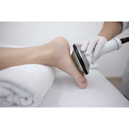 Focused shockwave therapy treatment for plantar fasciitis